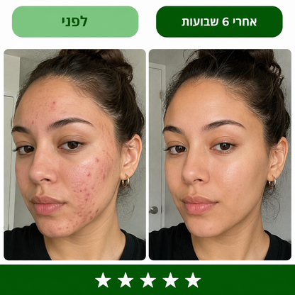 סבון כורכום טיפולי להבהרת עור הפנים והגוף
